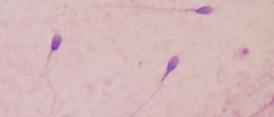 spermatozoide